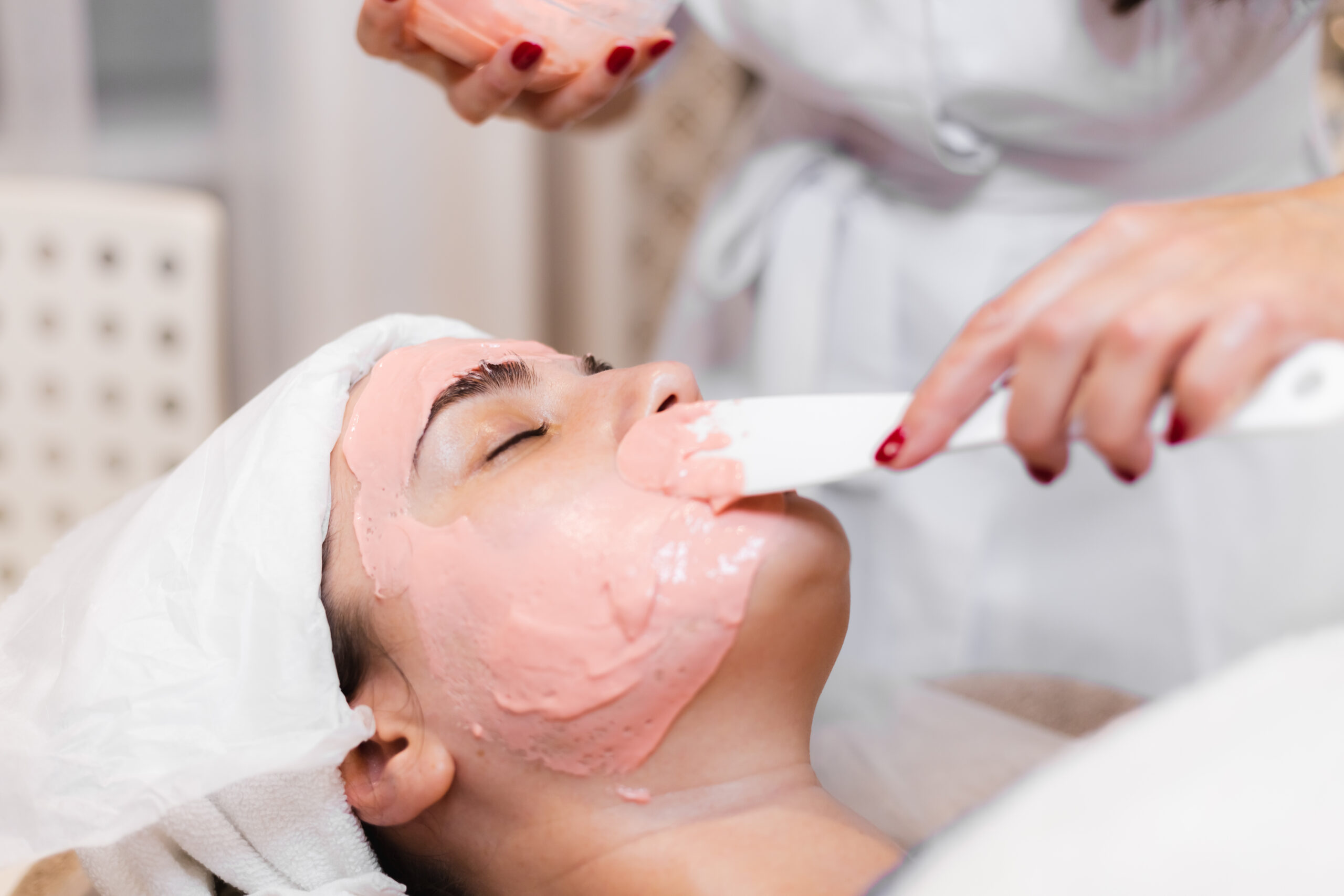 chemical peel