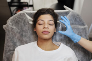 Microneedling