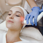 laser treatment for open pores